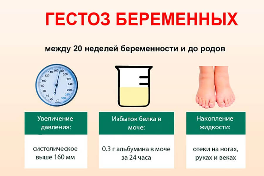 Поздний гестоз