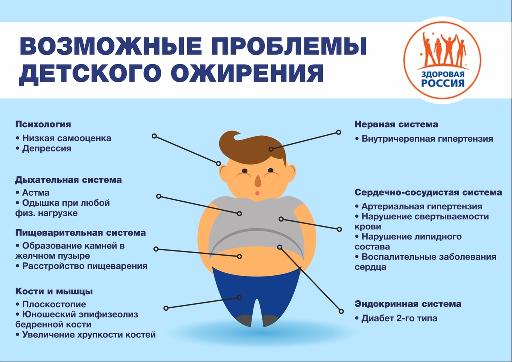 Проблемы с лишним весом у ребенка